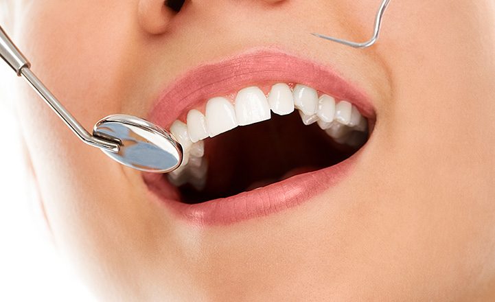 Why you should visit a dental clinic on a regular basis